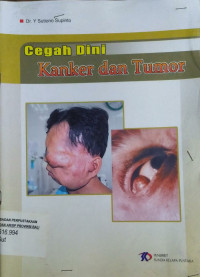 Cegah kanker dan Tumor